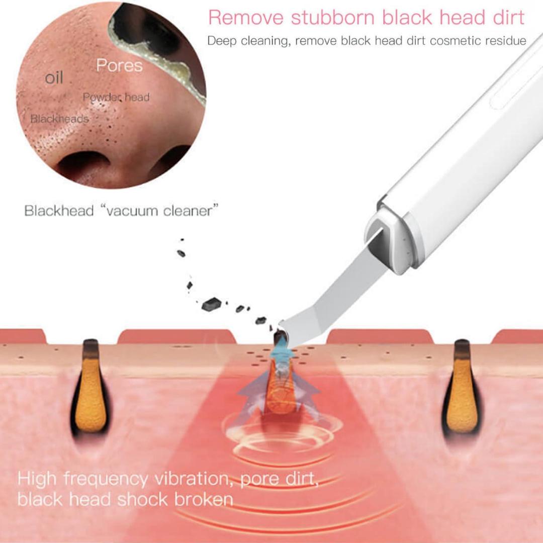 Face Blackhead Remover